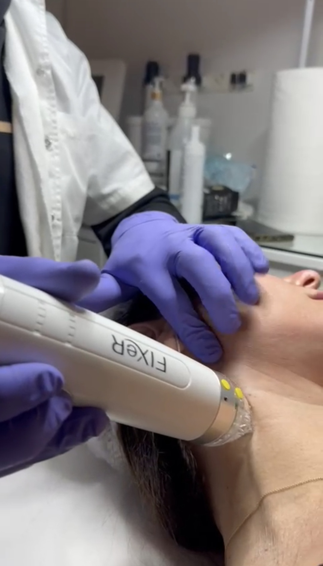 FixeR RF Microneedling בנתניה